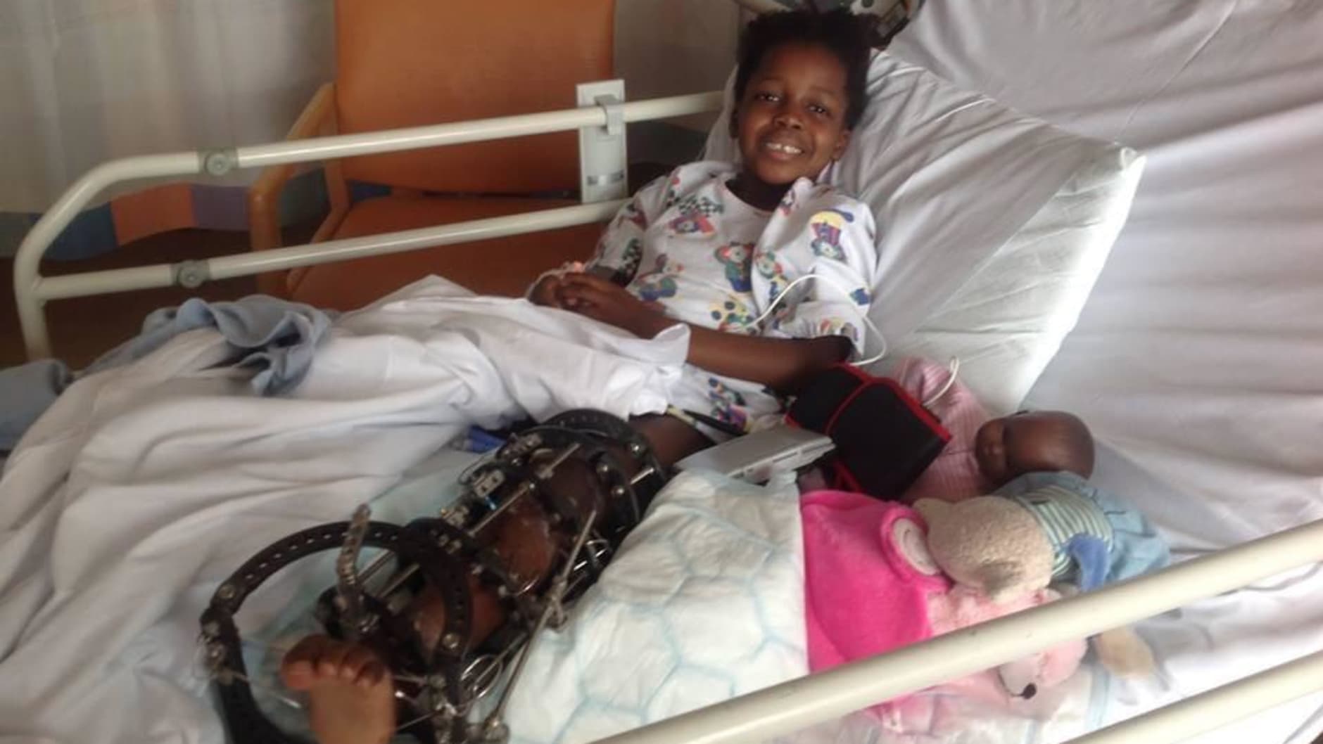 A young Victoria lays in a hospital bed after surgery on her leg. She has a contraption on her leg which is holding it together.